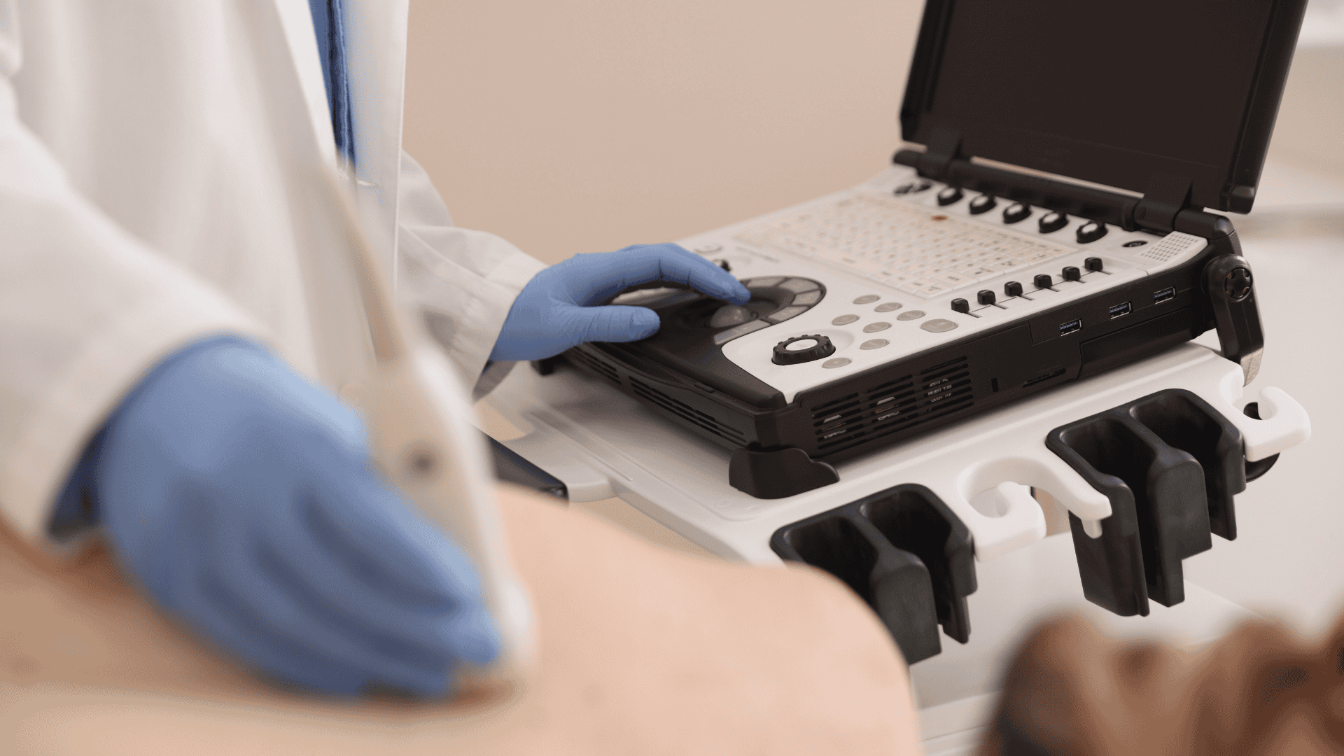 Ecocardiograma | Cardion